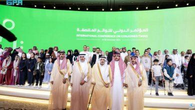 تدشين الموقع الإلكتروني للبرنامج السعودي للتوائم الملتصقة في افتتاح المؤتمر الدولي الخاص بهذه الحالات.. إليكم التفاصيل
