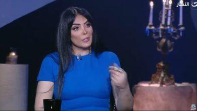 حورية فرغلي تكشف عن تفاصيل تركيب «أنف صناعية» في لندن