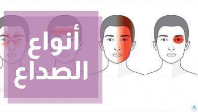 سر الصداع المستمر: كيف تميز بين الخطر والأمان