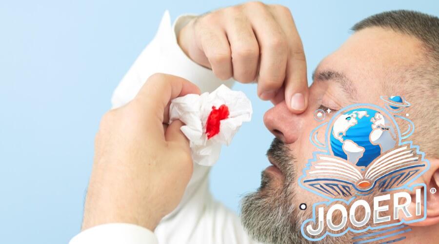 أفضل أدوية فعالة لعلاج النزيف بسرعة وأمان